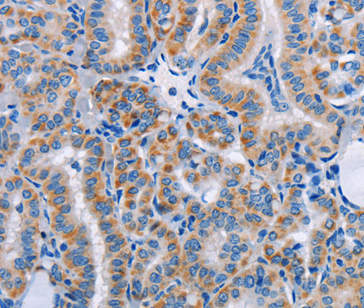 FN1 Polyclonal Antibody - 2