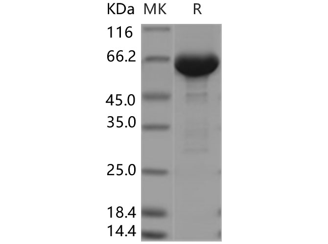 Recombinant Human Serum Albumin/HSA Protein - 1