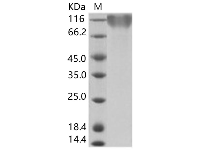 Recombinant Epstein-Barr virus (Herpesvirus 4) EBV Glycoprotein gp350 / EBV GP350 Protein (His Tag) - 1