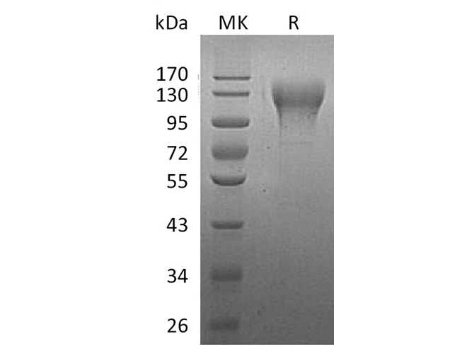 Recombinant Human CD96 Protein (His Tag) - 1