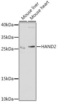 HAND2 Polyclonal Antibody - 1