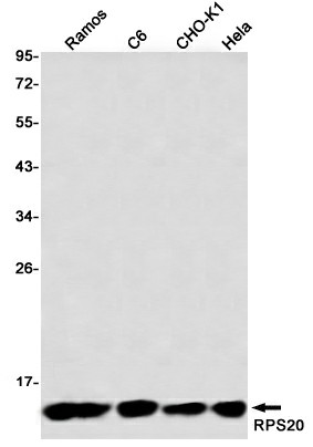 Recombinant RPS20 Monoclonal Antibody - 1