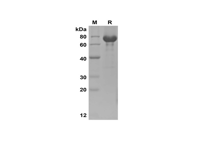 Recombinant Mouse IGF-1/Human HSA Fusion Protein(His Tag) - 1