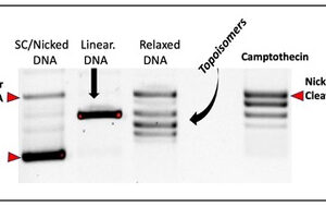 Topoisomerase I Assay