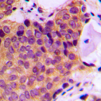 CPA1947-30ul | Rabbit Anti-JNK1/2/3 (Phospho-T183