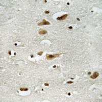 CPA5891-100ul | Rabbit Anti-ERK1/2 (Phospho-Y204) Polyclonal