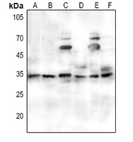 CPA5264-100ul | Rabbit Anti-PORIN Polyclonal Antibody