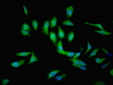Immunofluorescence(IF) - C1GALT1C1 Antibody