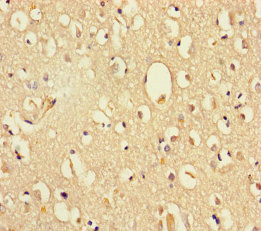 Immunohistochemistry(IHC) 1- DHX35 Antibody