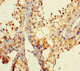 Immunohistochemistry(IHC) 2- DHX35 Antibody