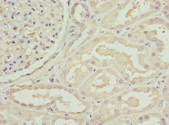 Immunohistochemistry(IHC) 1- C1GALT1C1 Antibody