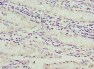 Immunohistochemistry(IHC) 2- C1GALT1C1 Antibody