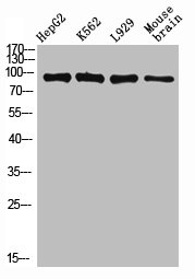 Western Blotting(WB) 2- PECAM1 Antibody