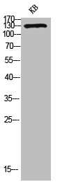 Western Blotting(WB) 3- PECAM1 Antibody