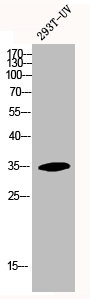 Western Blotting(WB) 1- HOXA11/HOXD11 Antibody