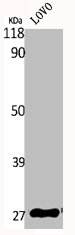 Western Blotting(WB) 2- HOXA11/HOXD11 Antibody