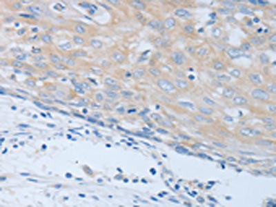 Immunohistochemistry (IHC) - CHRNA7 Antibody