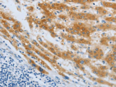 Immunohistochemistry (IHC) - CHRNA7 Antibody