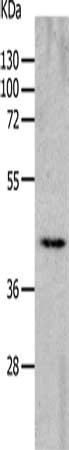 Western Blotting(WB) - CHRNA7 Antibody
