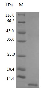 CSB-AP000741HU SDS-page