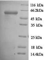 SDS-PAGE- Recombinant protein Porphyromonas rgpA