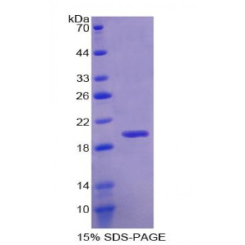 SDS-PAGE analysis of Human RBM20 Protein.