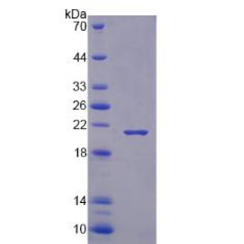SDS-PAGE analysis of RNA Binding Motif Protein 3 Protein.
