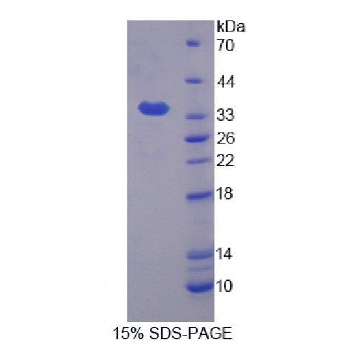 SDS-PAGE analysis of KHDRBS1 Protein.