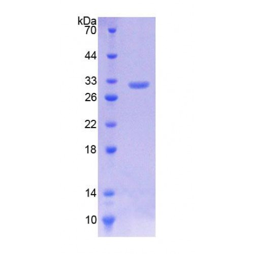 SDS-PAGE analysis of Human Kruppel Like Factor 5, Intestinal (KLF5) Protein.