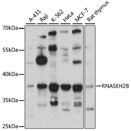 Western blot analysis of extracts of various cell lines using RNASEH2B Antibody (1/3000 dilution).