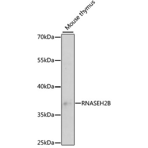 Ribonuclease H2 Subunit B (RNASEH2B) Antibody