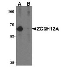 Western blot analysis of ZC3H12A in K562 cell lysate with ZC3H12A Antibody (Cat. No. 254251) at 1 ug/mL in absence (A) and in presence (B) of the blocking peptide.