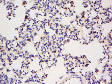 CD79a staining in rat lung. Formalin-fixed paraffin-embedded rat lung tissue is stained with CD79a Antibody (Cat. No. 250595) used at a 1:200 dilution.