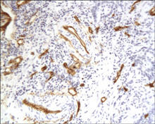 Paraffin-embedded mouse brain is stained with CD34 Antibody (Cat. No. 250591) used at 1:100 dilution.