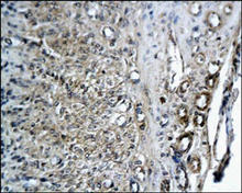 CD34 staining in rat endometrium. Paraffin-embedded rat eutopic endometrium is stained with CD34 antibody (Cat. No. 250591) used at 1:200 dilution.