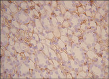 CD34 staining in rat kidney. Paraffin-embedded rat kidney is stained with CD34 antibody (Cat. No. 250591) used at 1:100 dilution (data from Liu et al., PLOS, 2013).