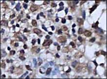 ER-alpha/beta staining in endometrium tissue. Formalin-fixed paraffin-embedded human endometrium tissue is stained with ER-alpha/beta Antibody (Cat. No. 250638) used at 1:200 dilution.