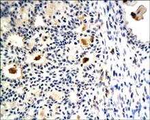 ER-alpha/beta staining in rat mammary tissue. Paraffin-embedded rat mammary tissue is stained with ER-alpha/beta Antibody (Cat. No. 250638) used at 1:200 dilution. 