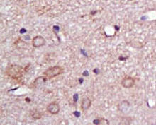 GLUT1 staining in rat brain. Formalin-fixed paraffin-embedded rat brain tissue is stained with GLUT1 Antibody (Cat. No. 250671) used at 1:200 dilution.