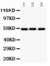 The GLUT1 Antibody (Cat. No. 250671) is used in Western blot to detect GLUT1 in lysates from (1) rat liver tissue, (2) SW620 cells, and (3) 293T cells.