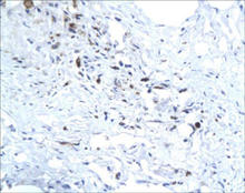 Hepatitis E virus (HEV) staining in human liver. Paraffin-embedded human liver tissue is stained with HEV antibody (Cat. No. 250688) used at 1:200 dilution.