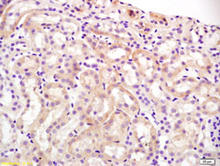 OAT-1 staining in mouse kidney. Formalin-fixed paraffin-embedded mouse kidney tissue is stained with OAT-1 (mouse) Antibody (Cat. No. 250798) used at 1:200 dilution.