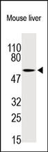 OAT-1 (mouse) Antibody (Cat. No. 250798) is used at 1:200 in Western blot to detect OAT-1 in mouse liver tissue lysates.