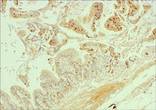 CD4 staining in mouse small intestine. Paraffin-embedded ileum of strain 129 IL-10-null mouse, 7 days after ileocecal resection, stained with CD4 Antibody (Cat. No. 251277) used at 1:200 dilution. 