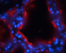 Formalin-fixed paraffin-embedded bovine mammary tissue is stained with Casein (Bovine) Antibody (Cat. No. 251309) used at 1:500 dilution. Casein (red) is localized by the lumen lining (data provided by Julie Kim at University of Guelph, Canada).