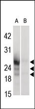 The Casein (Bovine) Antibody (Cat. No. 251309) is used in Western blot at 1:4,000 dilution to detect bovine casein in 30 ug bovine mammary tissue lysate (A) and 5 ug bovine mammary primary cell lysate (B). Data provided by Julie Kim at University of Guelph, Canada.