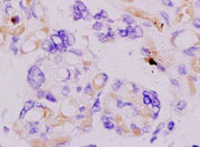 Adipophilin staining in placenta. Formalin-fixed paraffin-embedded human placenta tissue is stained with Adipophilin Antibody (Cat. No. 251533) used at 1:200 dilution.