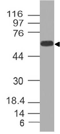 Monoclonal Antibody to CD73 (Clone: ABM40E2)