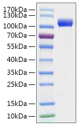 Recombinant SARS-CoV-2 Spike S1 Protein (His Tag)
