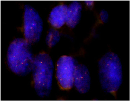 Fluorescent <i>In Situ</i> Hybridization (Formalin/PFA-fixed paraffin-embedded sections) 